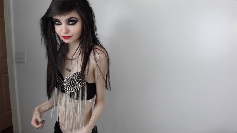 Eugenia Cooney anorexia