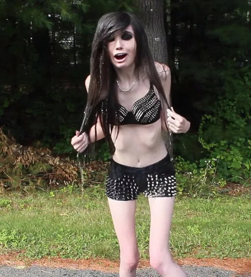 Eugenia Cooney Anorexic