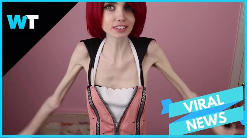Eugenia Cooney Anorexic